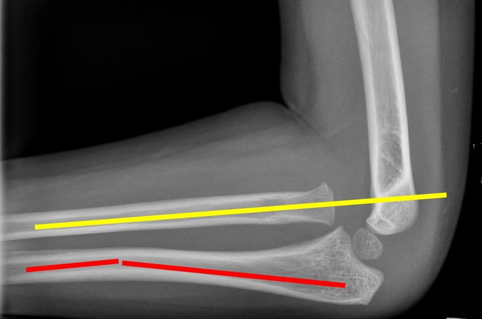 radiografia_1