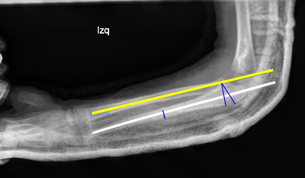 radiografia_2